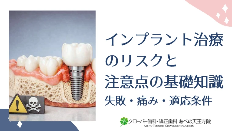インプラント治療のリスクと注意点の基礎知識｜失敗・痛み・適応条件