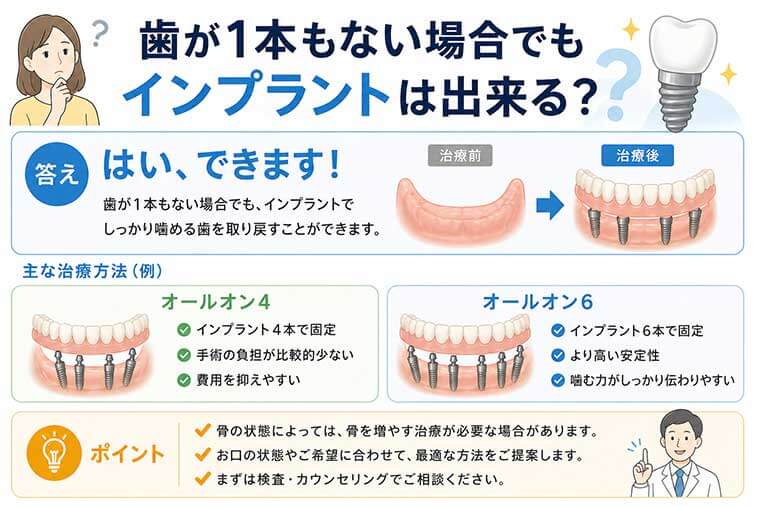 歯が1本もない場合でもインプラントは出来る？の図解