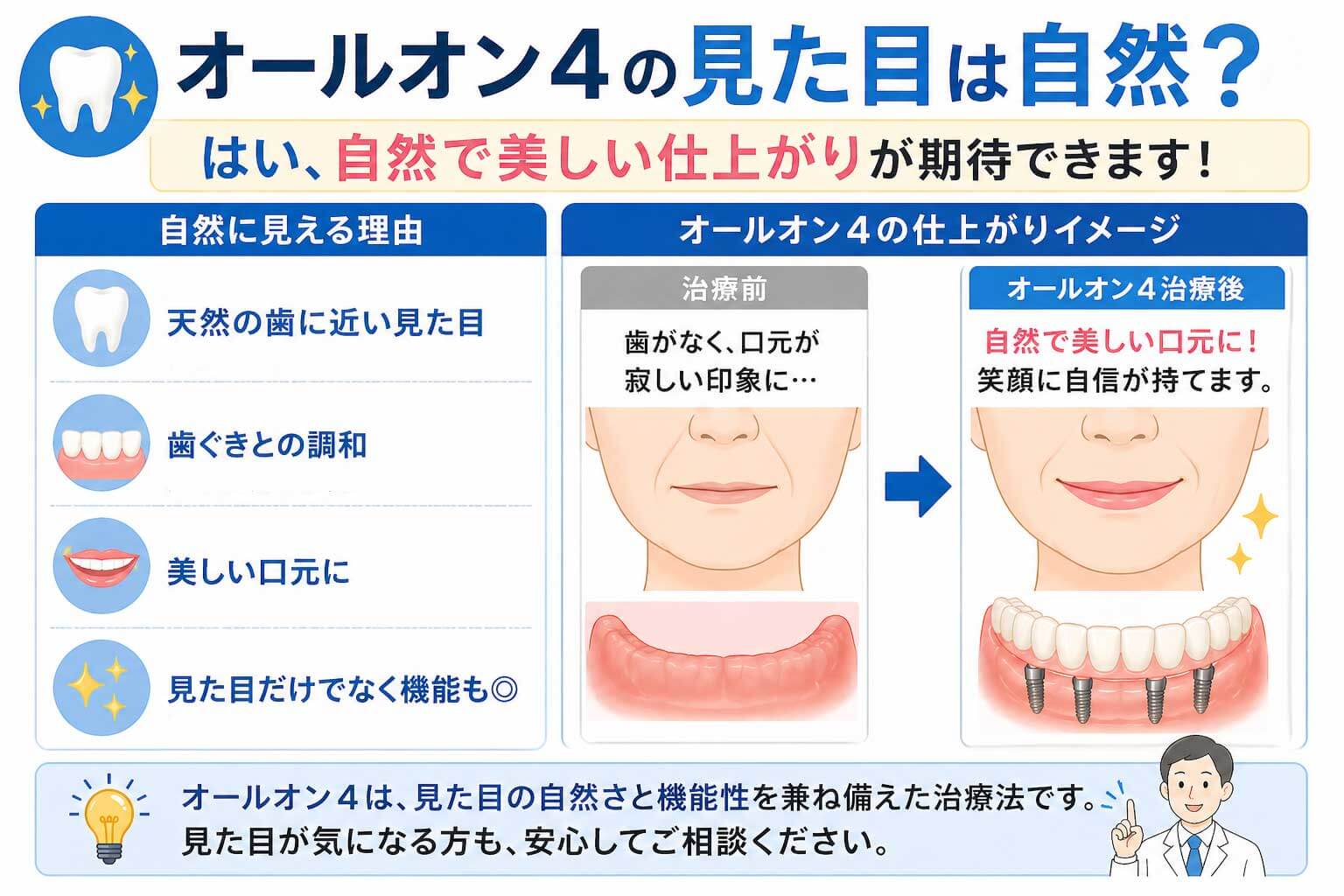 オールオン4の見た目は自然？の図解