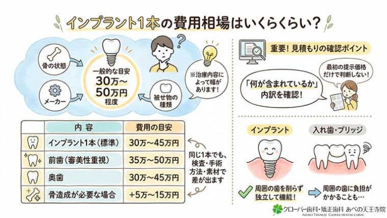 インプラント1本の費用相場はいくらくらいですか？の図解