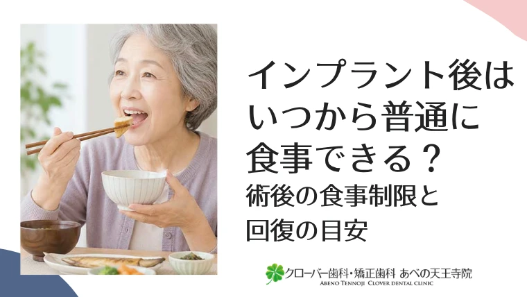 インプラント後はいつから普通に食事できる？術後の食事制限と回復の目安