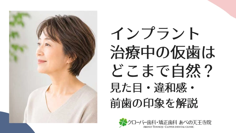 インプラント治療中の仮歯はどこまで自然？見た目・違和感・前歯の印象を解説