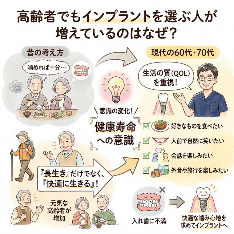 高齢者でもインプラントを選ぶ人が増えているのはなぜ？の図解