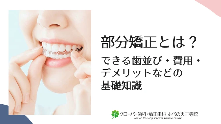 部分矯正とは？できる歯並び・費用・デメリットまでわかる基礎知識