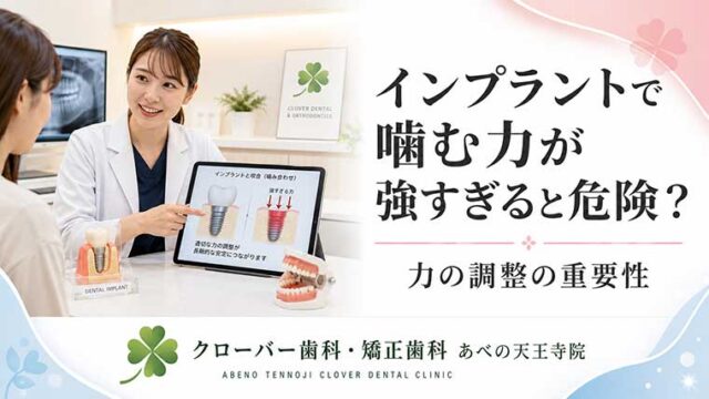 インプラントで噛む力が強すぎると危険？力の調整の重要性