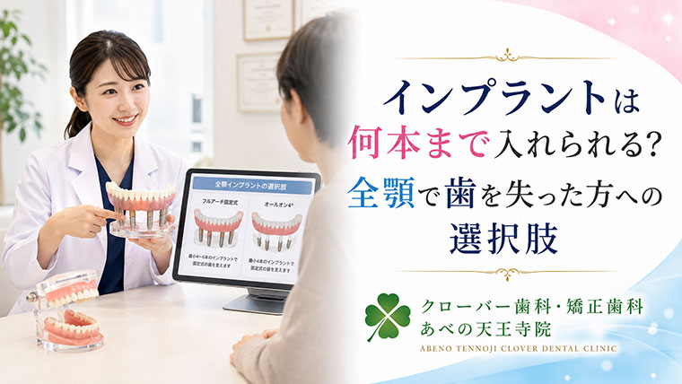 インプラントは何本まで入れられる？全顎で歯を失った方への選択肢