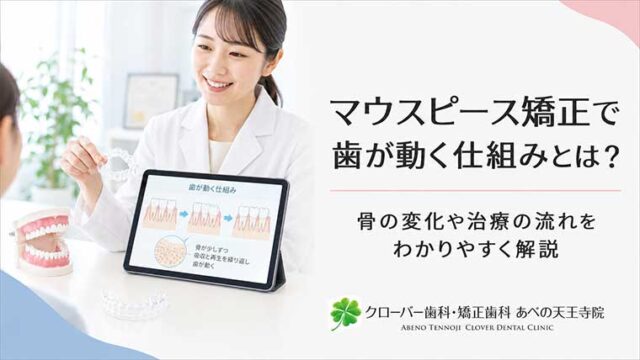 マウスピース矯正で歯が動く仕組みとは？骨の変化や治療の流れをわかりやすく解説