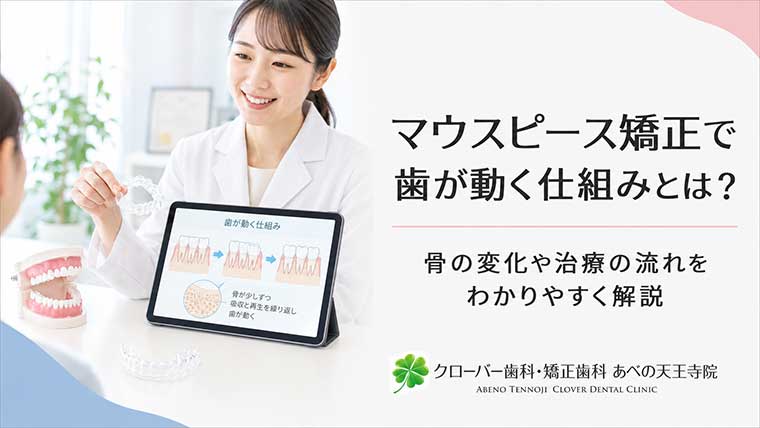 マウスピース矯正で歯が動く仕組みとは？骨の変化や治療の流れをわかりやすく解説