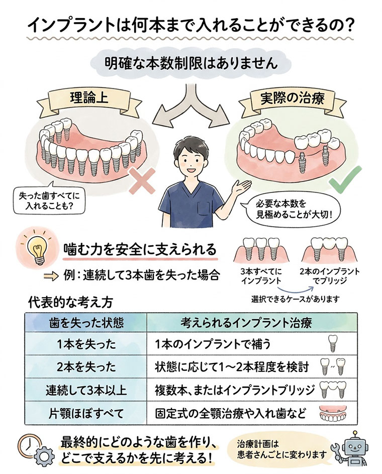 インプラントは何本まで入れることができるの？の図解