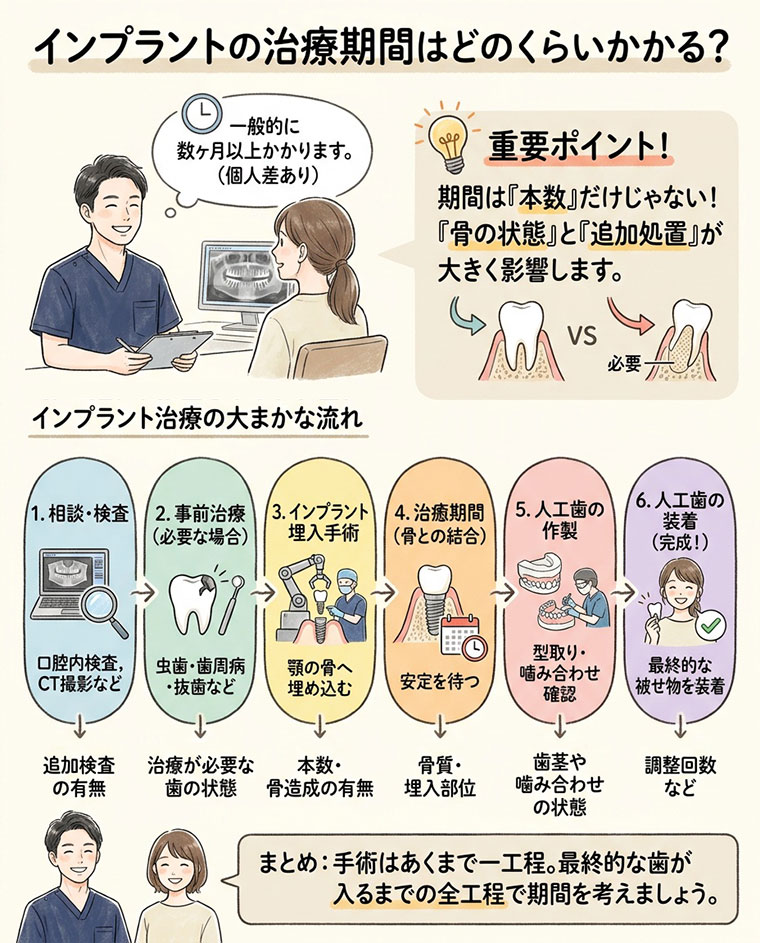 インプラントの治療期間はどのくらいかかる？の図解