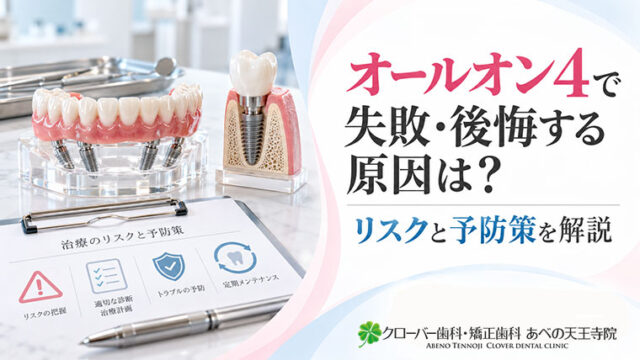 オールオン4で失敗・後悔する原因は？リスクと予防策を解説