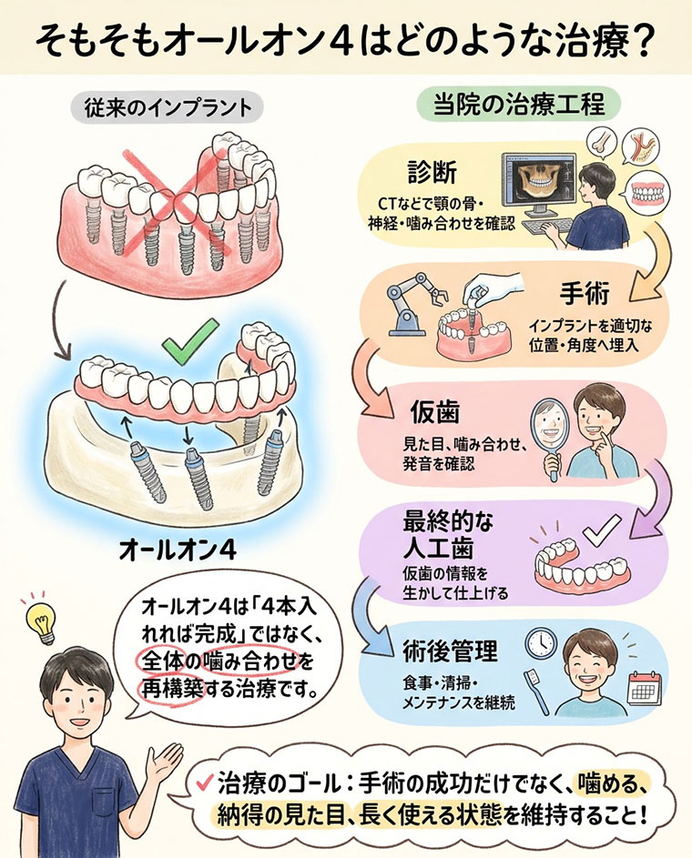 オールオン4はどのような治療？の図解