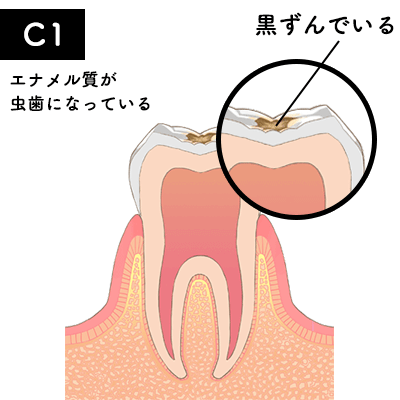 C1