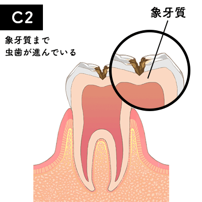 C2