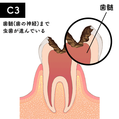 C3