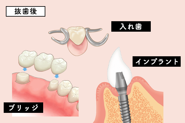 ꎕEubWECvg