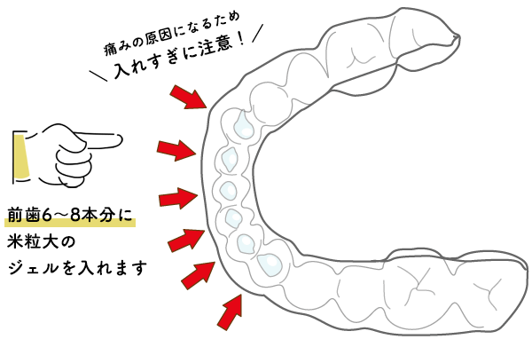 }EXs[XɃWF𒍓